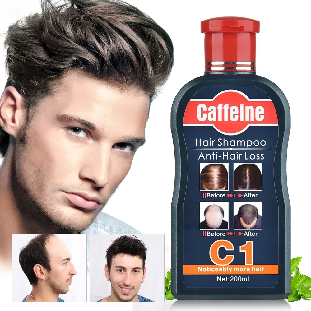 Hair Care Korean Products - 男性シャンプー育毛のための天然植物カフェイン抗脱毛フケ栄養ケアトリートメントシャンプー 200 ミリリットルヘアケア