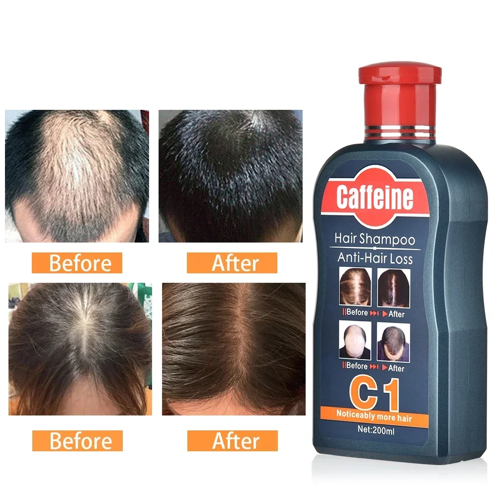 男性シャンプー育毛のための天然植物カフェイン抗脱毛フケ栄養ケ - Hair Care Korean Products のレビューと価格